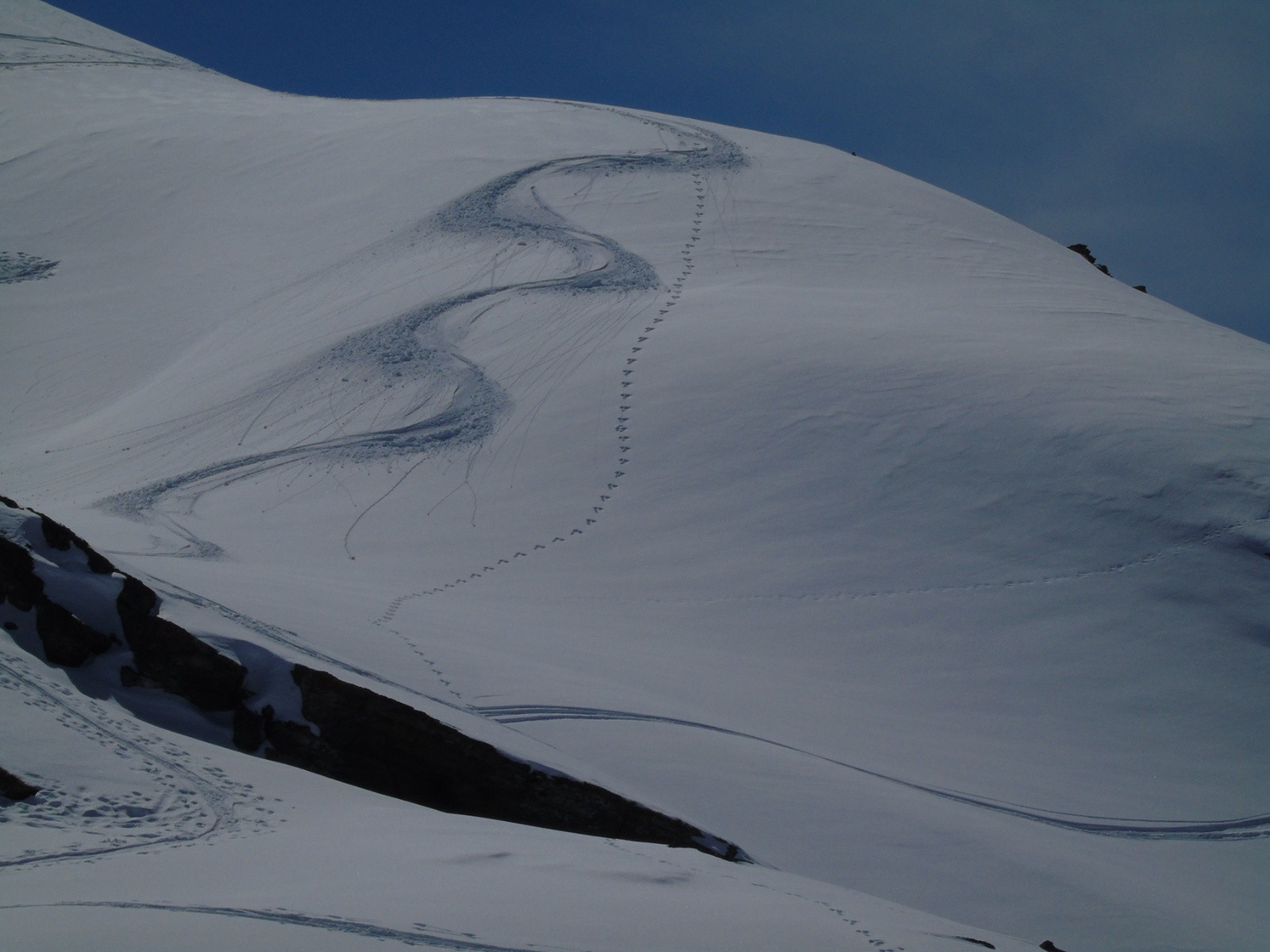 Ah ben j'ai fait de jolies traces juste sous le col!