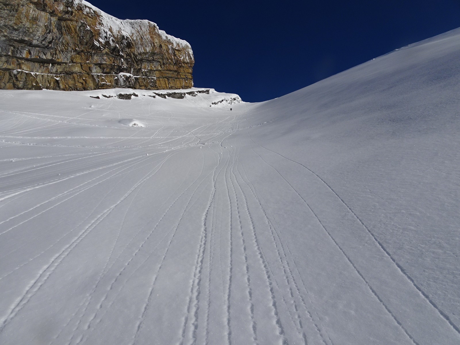 Dans la plaque sommitale ,le traceur du jour