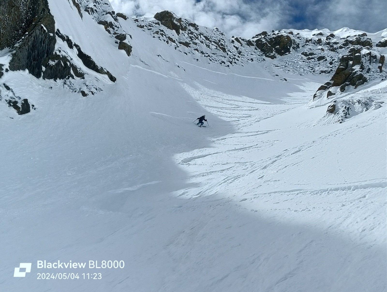 Partie médiane&nbsp;