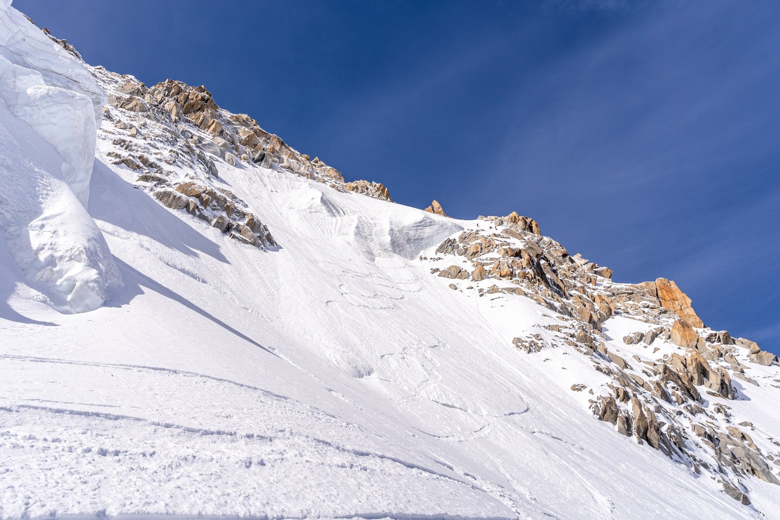 &nbsp;Le haut de la face