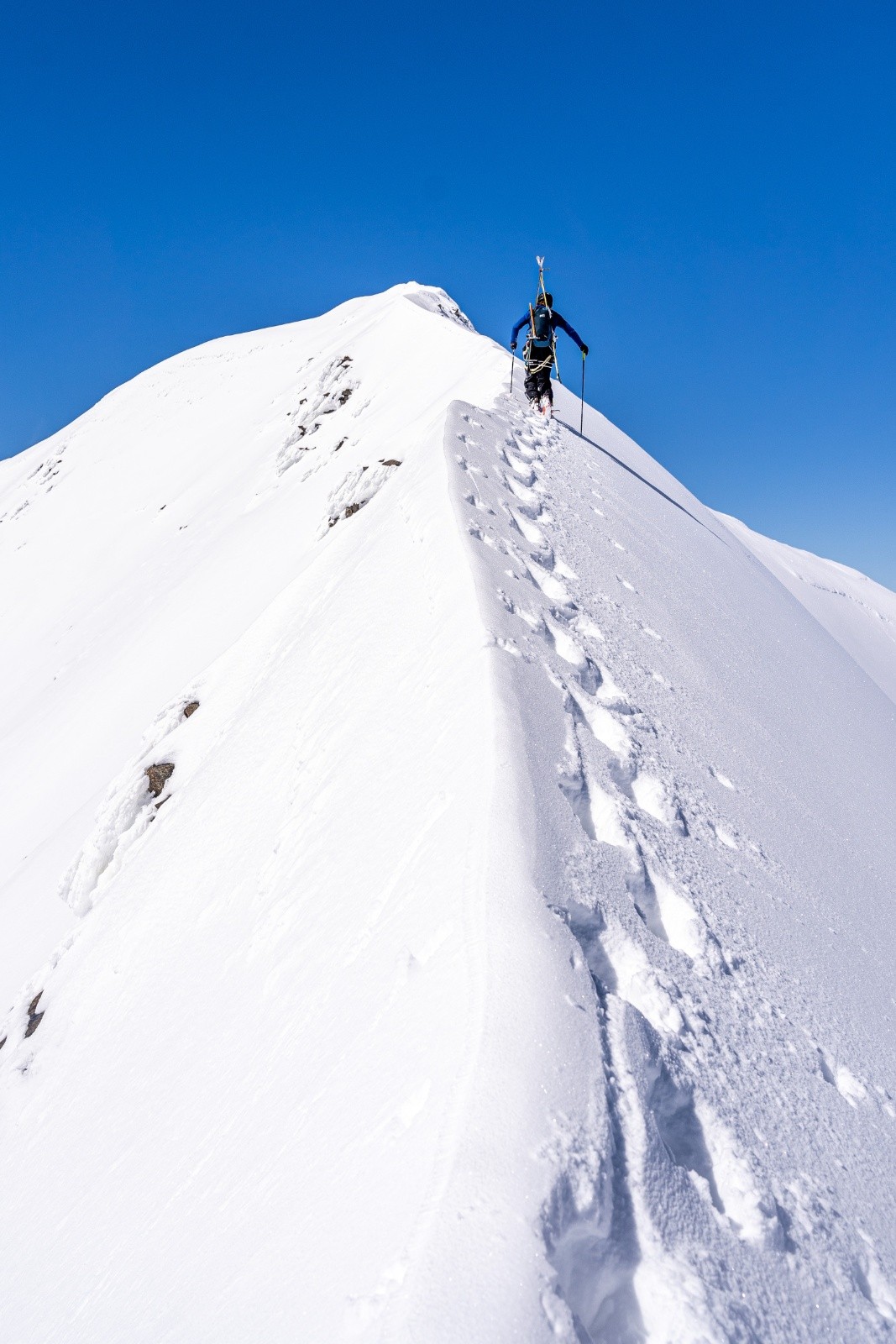 Arete finale bien esthétique 