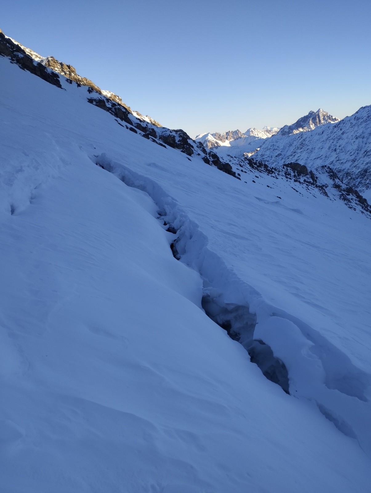 #5 Gueule de baleine ? Sous le col de petit Jean Gueule de baleine ? Sous le col de petit Jean