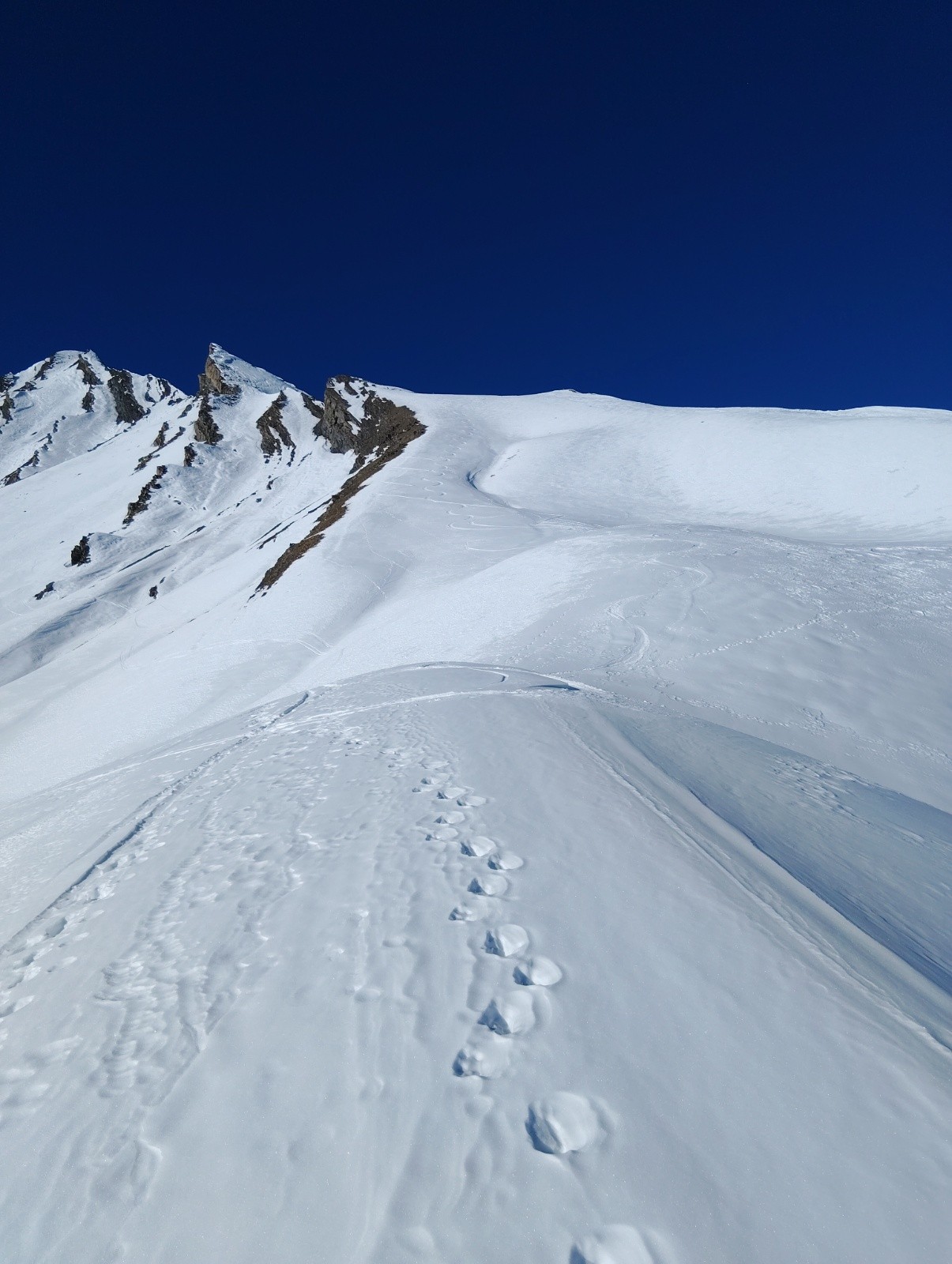 #18 L L'épaule skiee