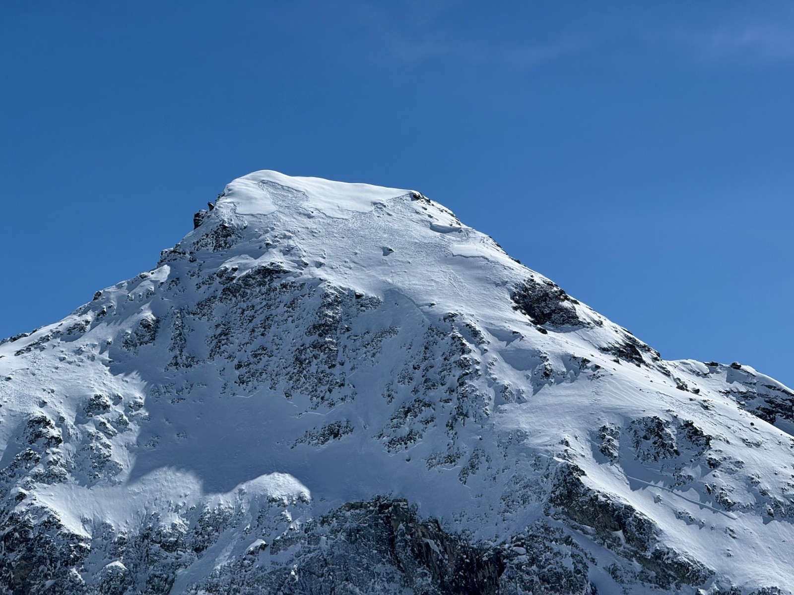 #9 Pelvas c’est descendu ! Pelvas c’est descendu !