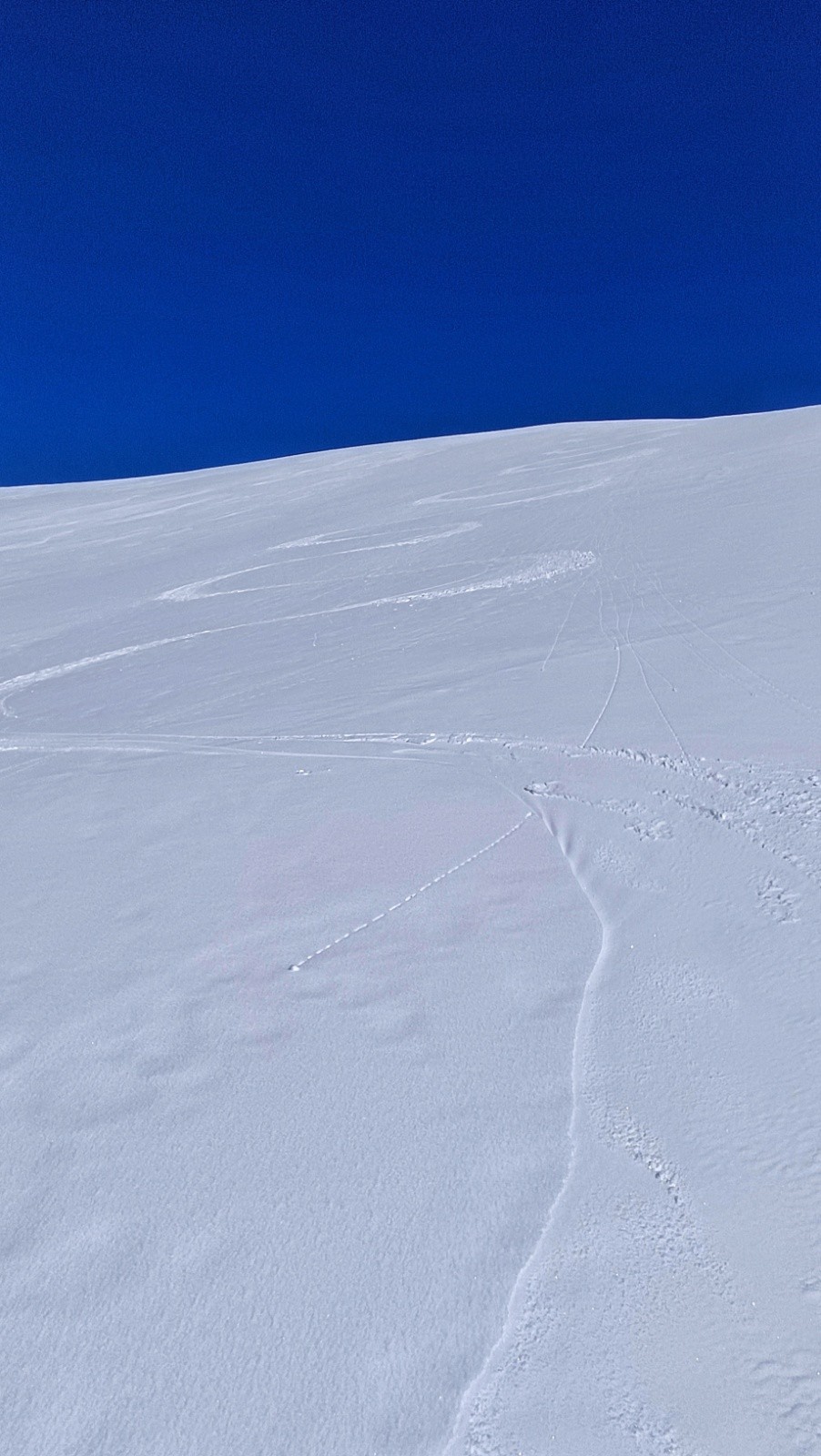 La partie haute&nbsp;