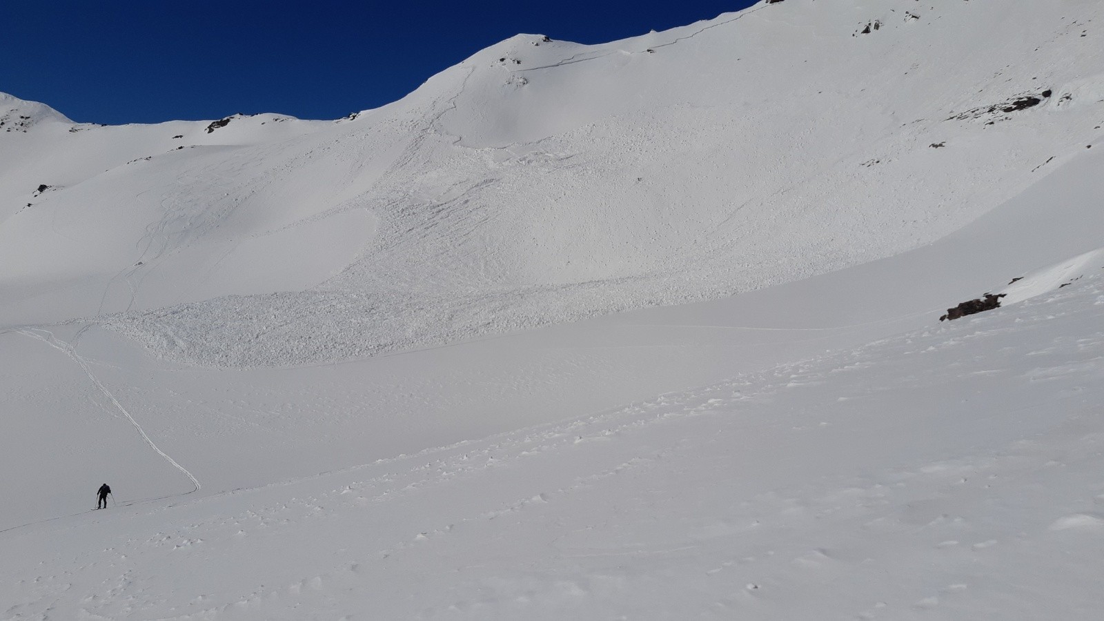 Toute la face est partie...&nbsp;