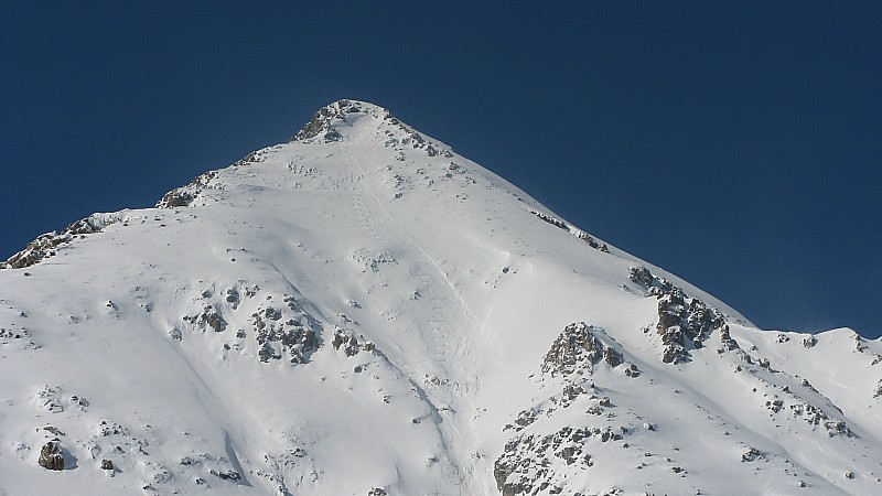 haut de la face