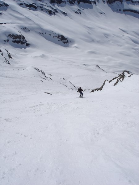 Le milieu de la face : La partie la plus raide dans le milieu de la face