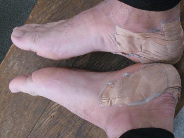 Mes pieds : Pas une ampoule de la saison et voici le résultats de 2 jours en Belledonne. Une affaire de spécialiste.