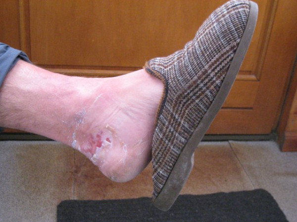 Des pieds : Jean-Marc essaie de jouer dans la même catégorie !