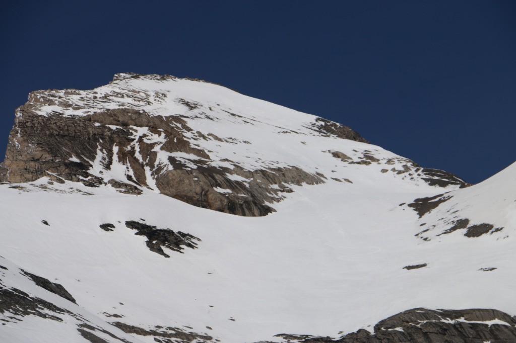 #18 Le haut de la face Le haut de la face